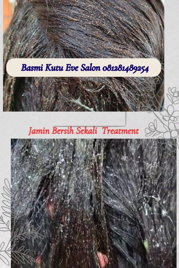 salon basmi kutu bekasi utara
