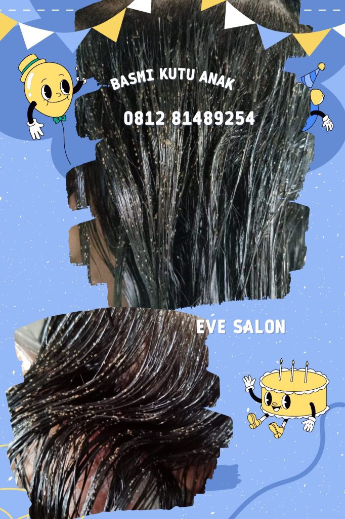 Salon Kutu Rambut Di Ciracas Jakarta Timur