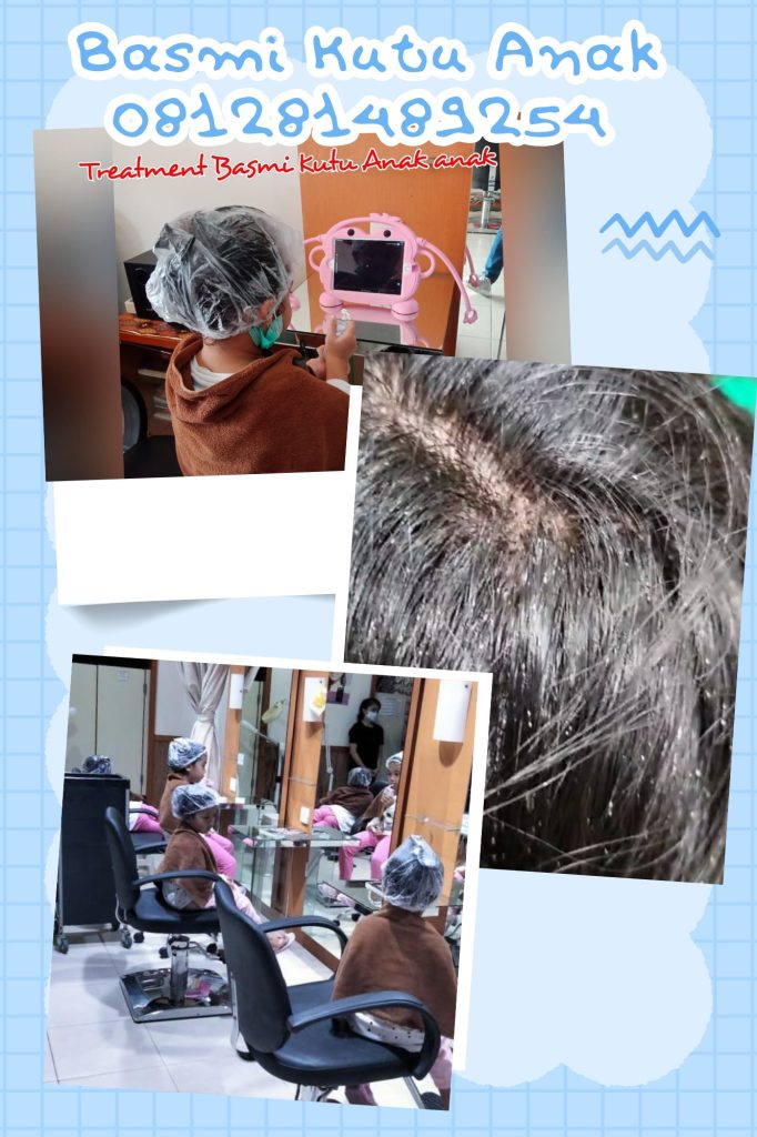 Salon Kutu Di Kramat Jati Jakarta Timur