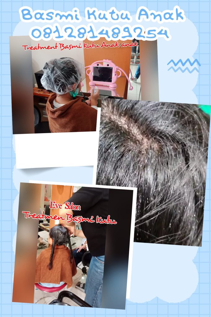 Salon Kutu Di Duren Sawit Jakarta Timur