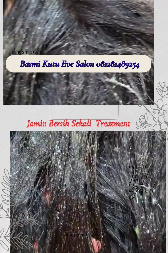 salon kutu di medan satria bekasi