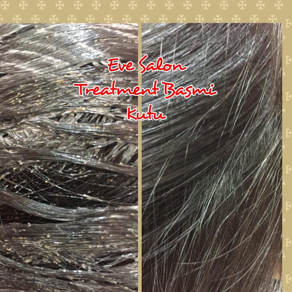 Salon Basmi Kutu Di Cakung