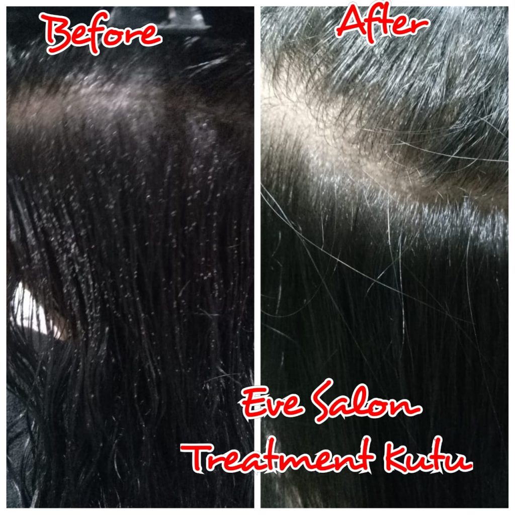 Salon Basmi Kutu Di Pondok Melati Bekasi