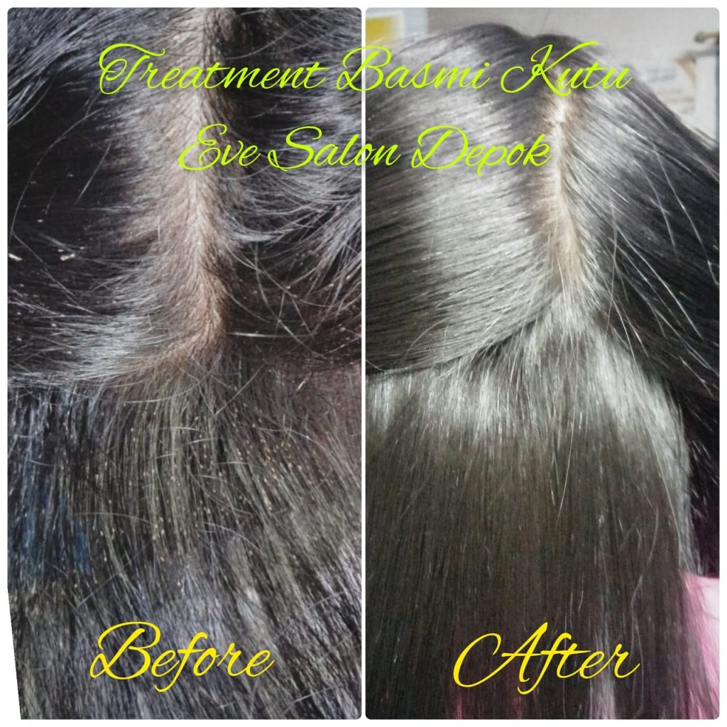 Rekomendasi salon kutu Di Bantargebang Bekasi