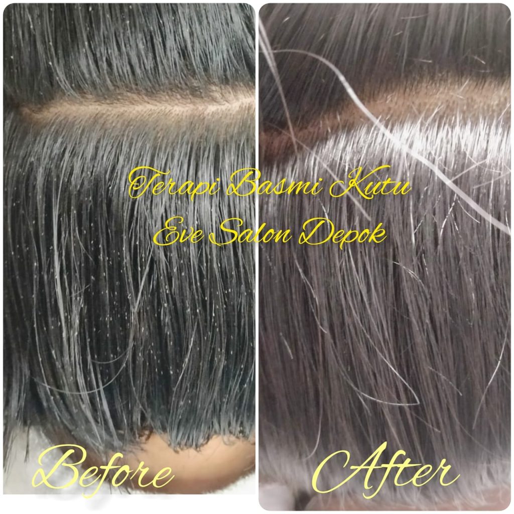 Rekomendasi salon kutu Di Bantargebang Bekasi