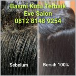 Salon Kutu Bekasi Terbaik