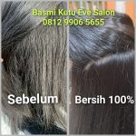 Salon Kutu Bekasi Terbaik