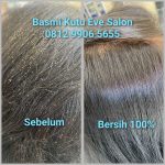 Salon Kutu Bekasi Terbaik