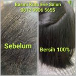 Rekomendasi Salon Kutu Bekasi