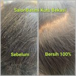 Perawatan Rambut Berkutu di Galaxy Jatiasih Bekasi – Bersih Total Sekali Treatment di Eve Salon
